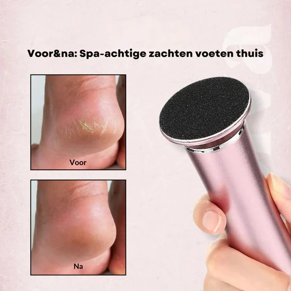 HeelGlow™ – Elektrische Eeltverwijderaar voor zachte, gladde voeten. Tijdelijk exclusief bij Lifefix i.p.v 60 nú 260 gratis schuurpads (80 zacht & 180 harde)